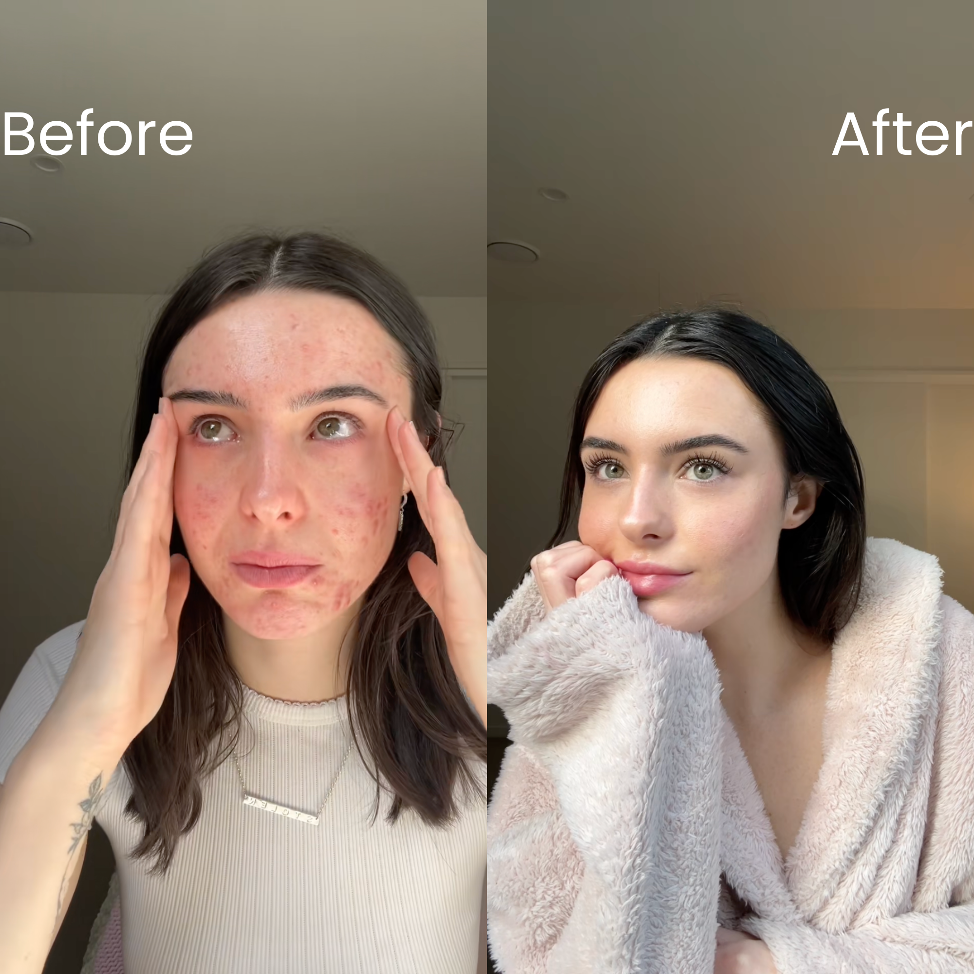 Onisiee Retinol 0.2 Serum