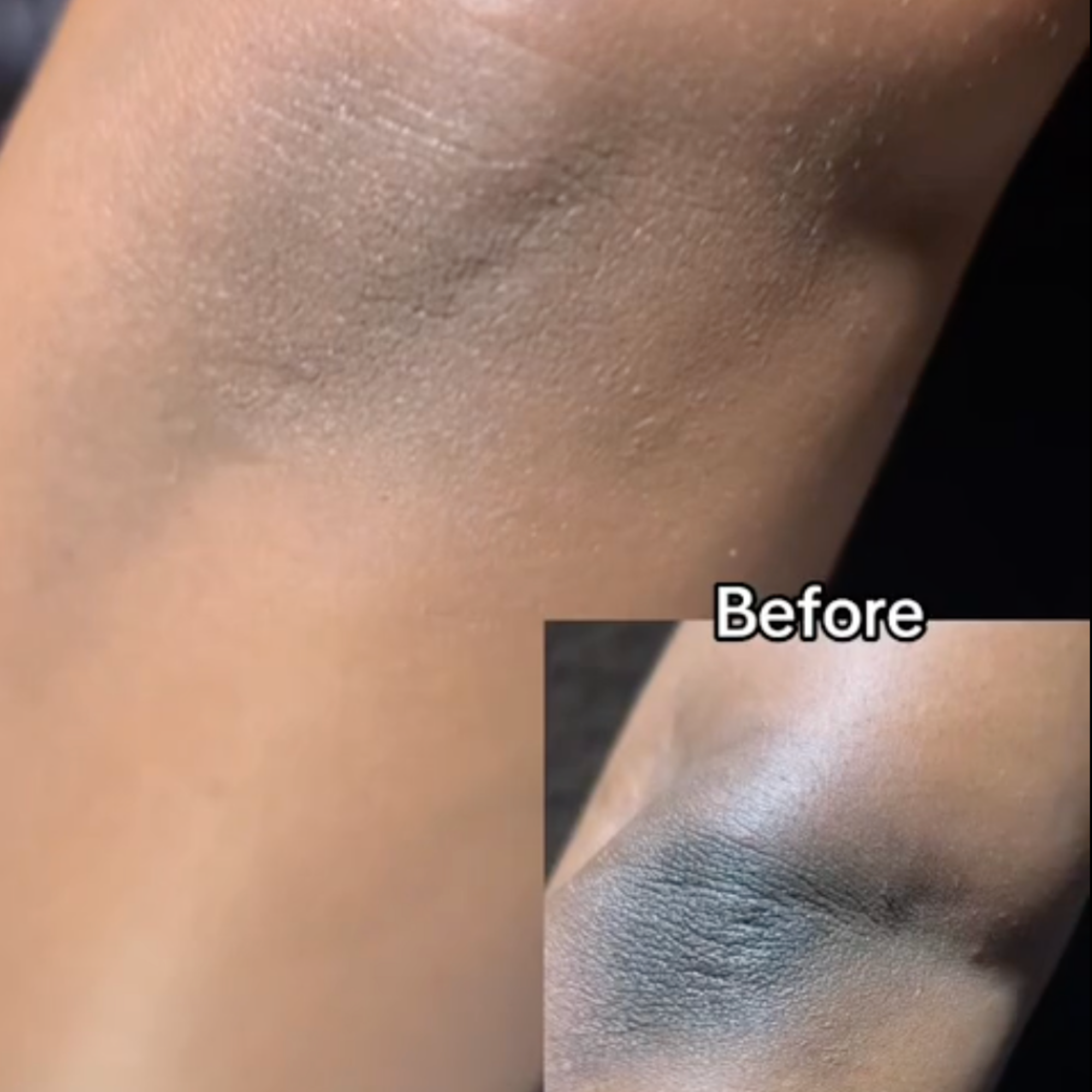 Onisiee Retinol 0.2 Serum